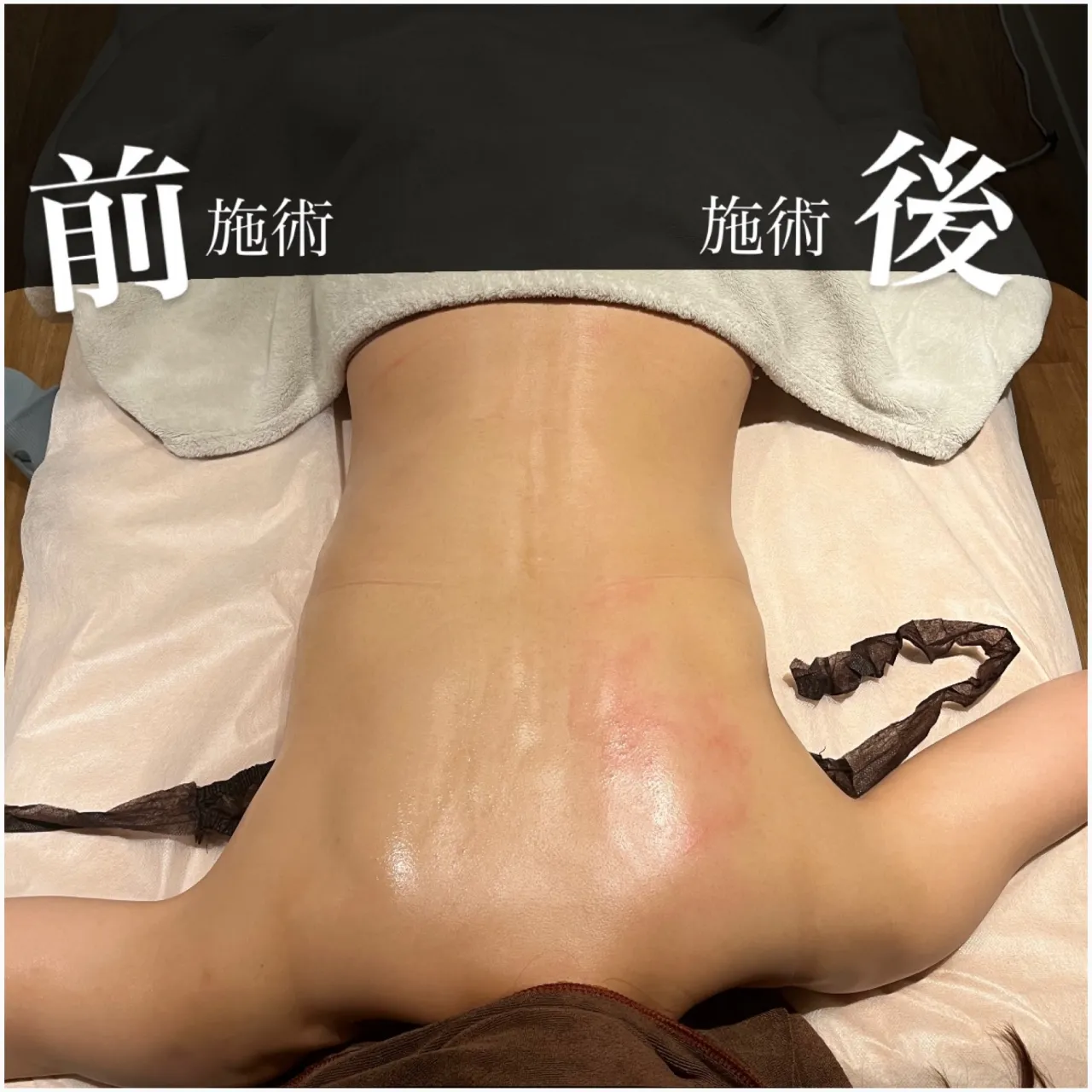 呼吸がしづらいは