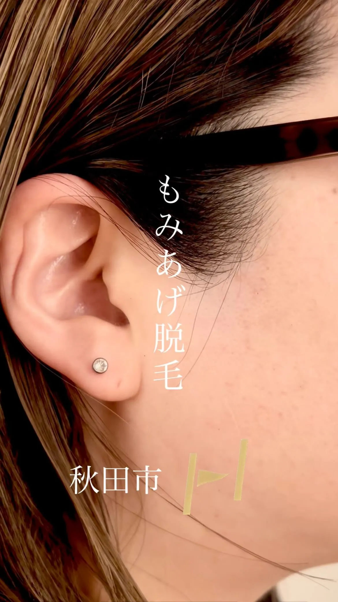 気になっていて剃っていた