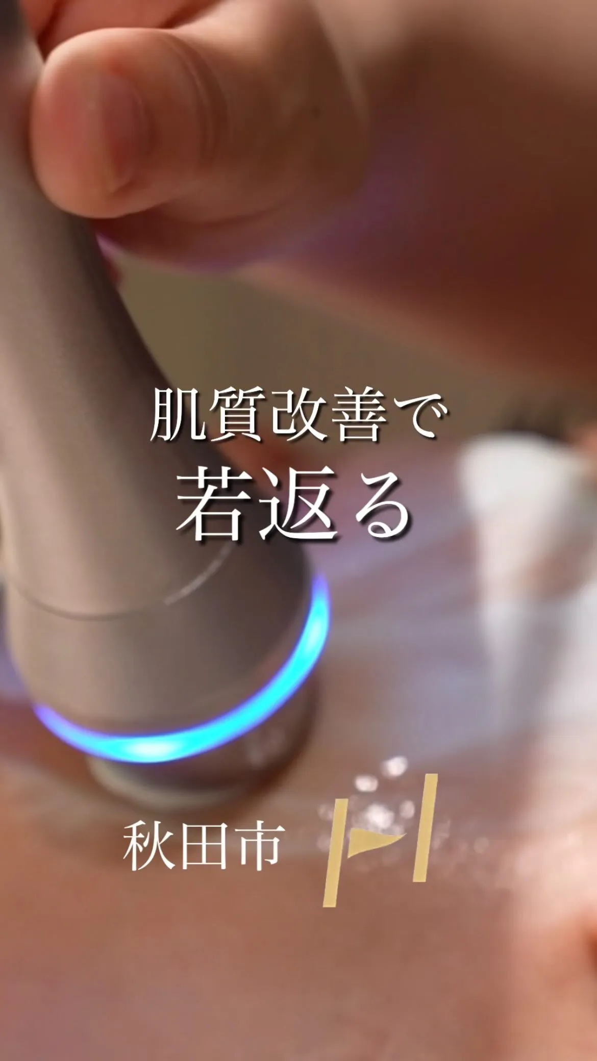 本気の肌質改善【秋田市】