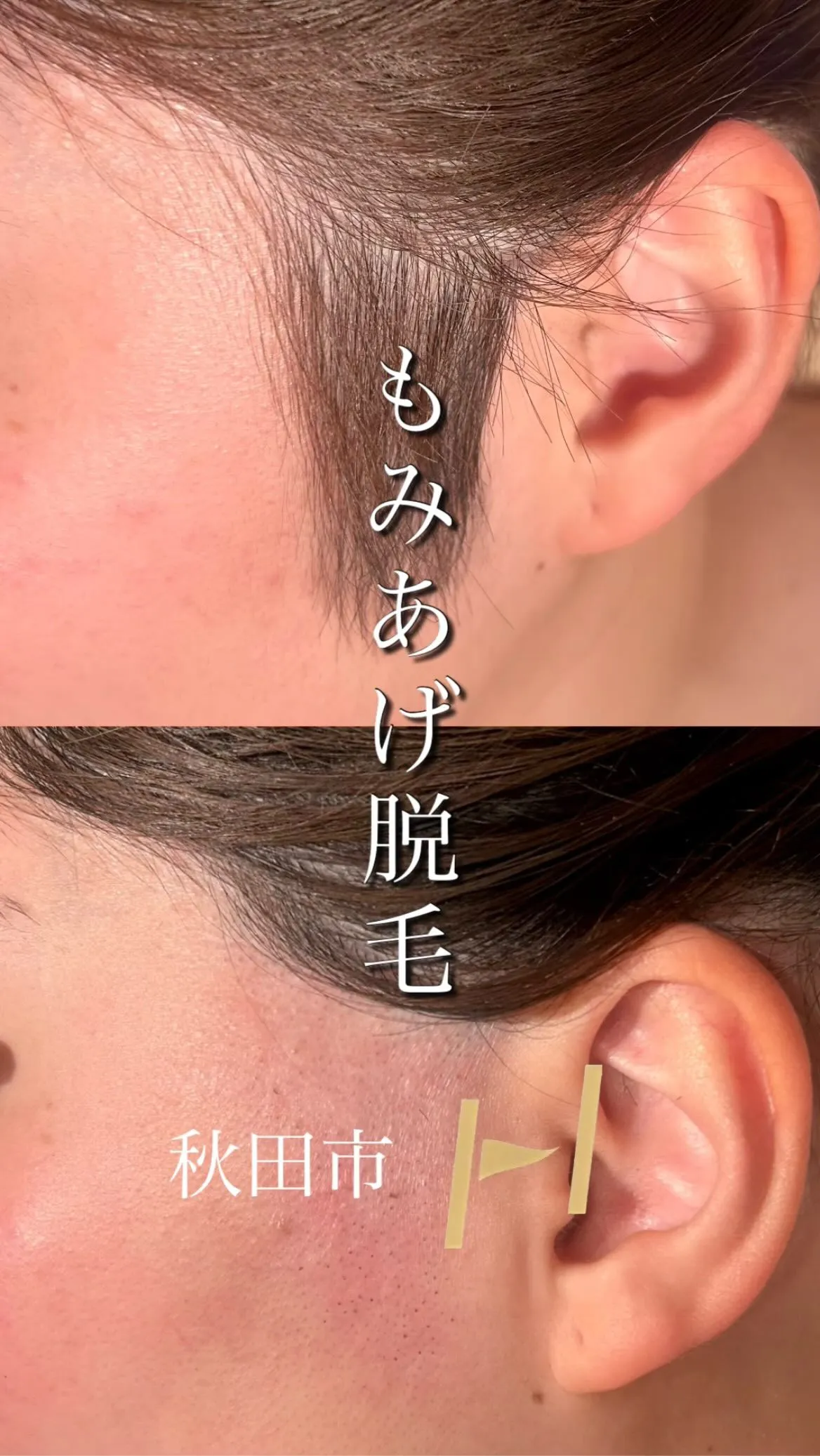 気になっていて剃っていた