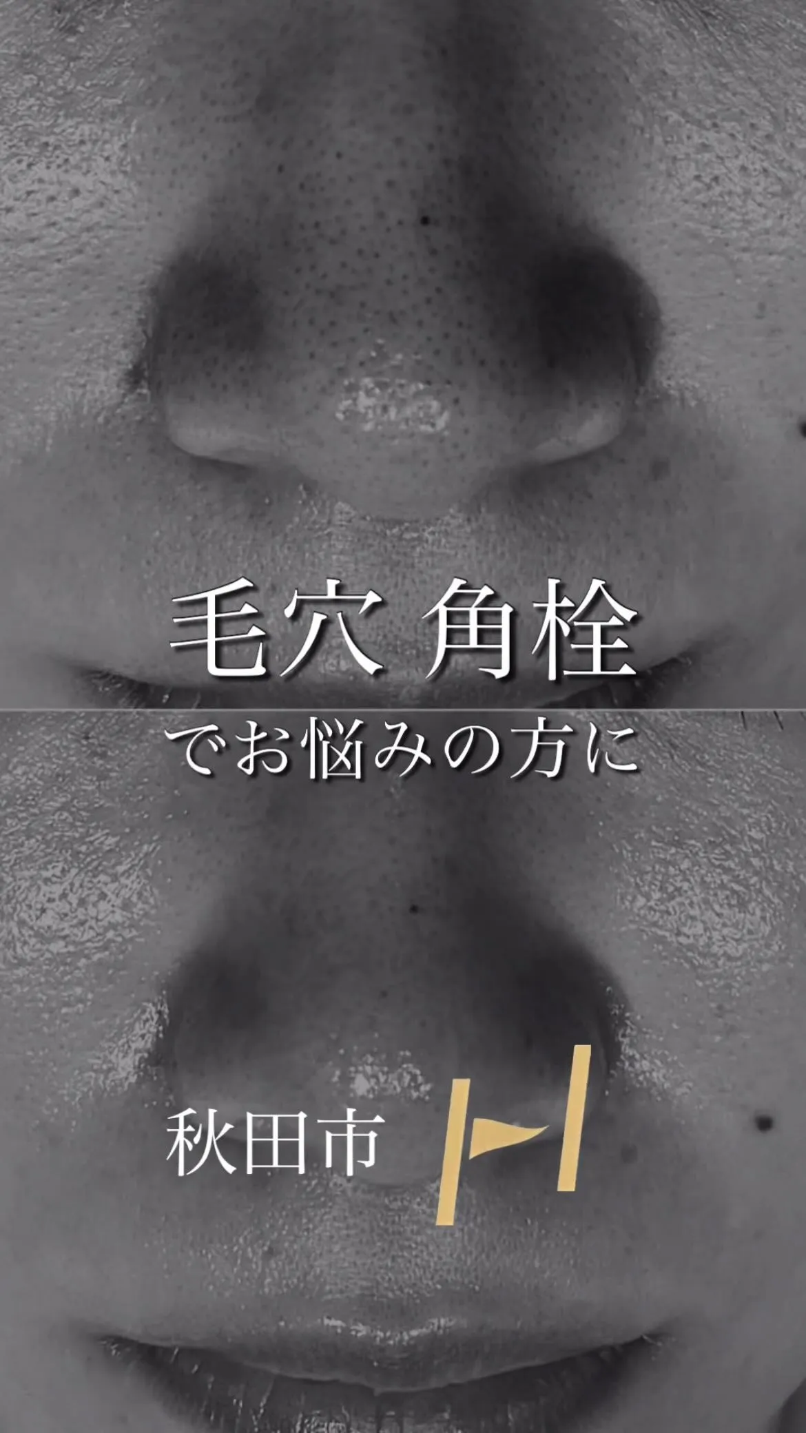 この間自分で押し出して